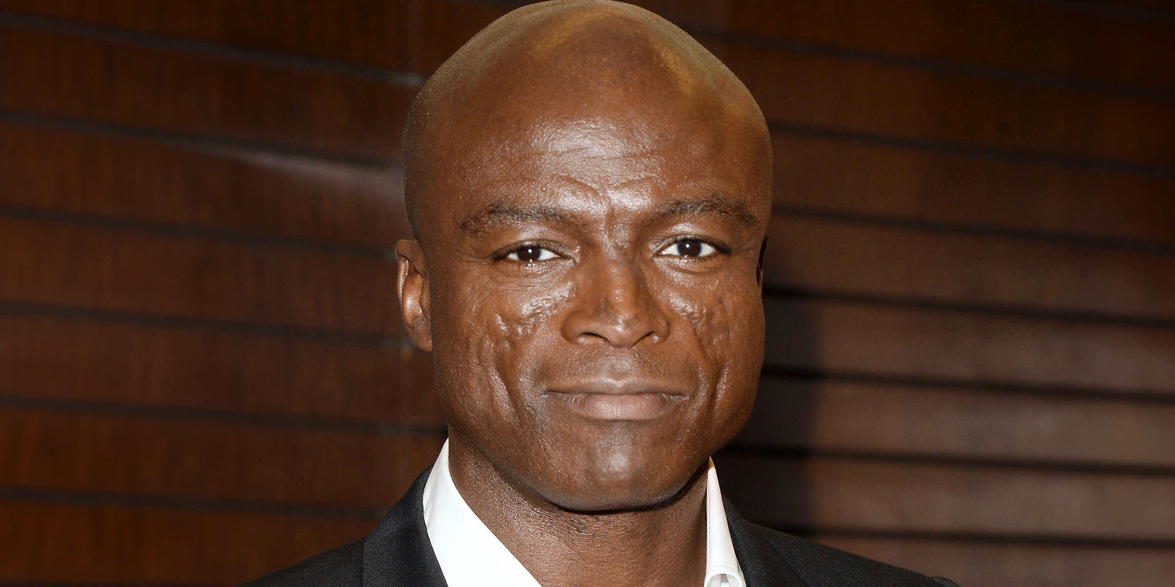 Why Singer Seal Has Scars on His Face – 3 Pics of What He Would Look Like without Them